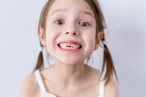 برخی مشکلات دهان و دندان کودکان گذرا هستند