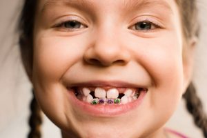 زمان طلایی درمان های ارتودنسی از زمان رویش اولین دندان‌های دائمی یعنی حدود 6-7 سالگی است