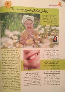 مقاله روکش دندان شیری کودکان در هفته نامه سلامت